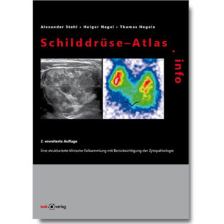 Schilddrüse-Atlas